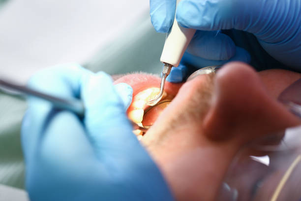 Best Knocked-Out Tooth Emergency  in Alpena, MI