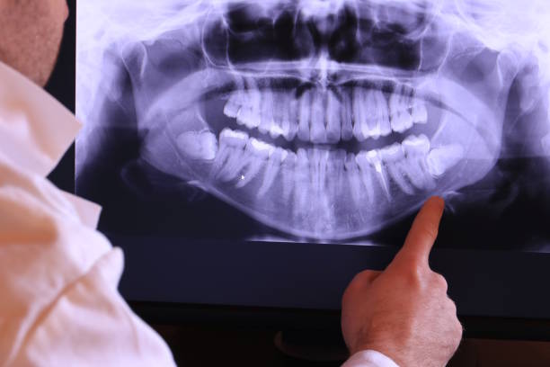 Best Urgent Tooth Repair  in Alpena, MI